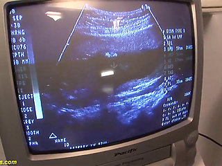 Redhead preggo fucked at the clinic