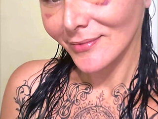 Day 8 Face Lift Recovery....