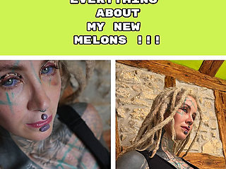 Why I Have the Implant Size for My Boobs Like This?