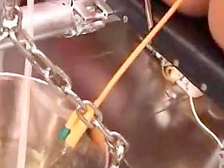 Bladder filling through catheter
