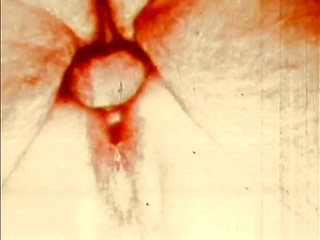 The Appetizing Sucker