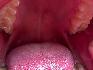 Kate open her mouth wide for you