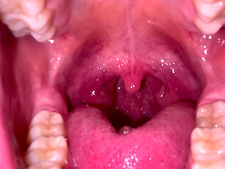 Mouth Tour No Makeup Teeth Tongue Uvula Tonsils Check