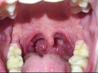 A Close-up of My Throat