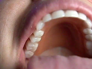 Mouth Tour with Dentures in
