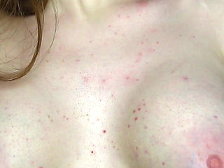 Revealing My Boobs After Breast Reconstruction (3-week Progress Update)