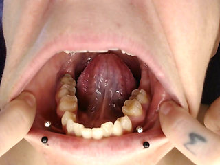 Climb Inside Wide Open Teeth Tongue Mouth Show