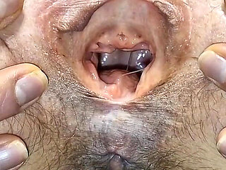 Gynecology Chair Play and Gaping