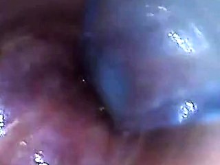 Endoscope POV Test Tube Cock Urethral Insertion