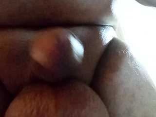Saline ball latino scrotum 1