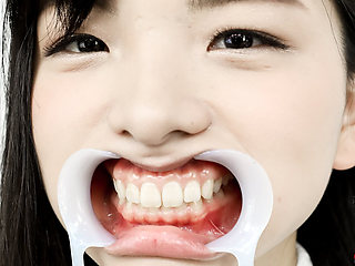 Teeth Observation Natural Teeth but Potential Cavities Found!! Beauty Winces When Her Teeth Are Tapped - Suzu Shiratori