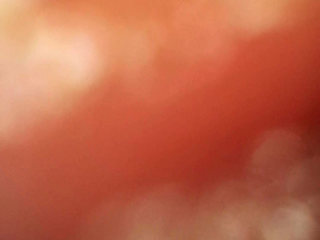Close up of buttplug & HD Endoscope insertion