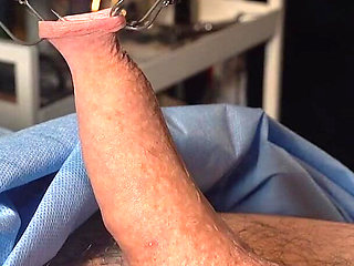 Needle CBT at It's Finest.