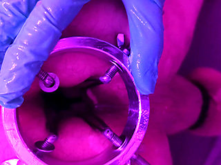 -part 1- Anal dilation of my submissive switch. Fist, ball coler and dilator