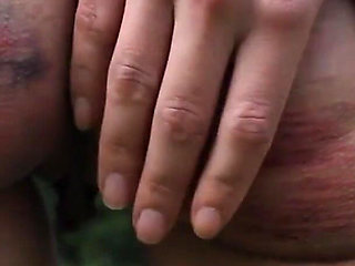 Slave Mila Plays with Her Bruised Caned Bottom Outdoors