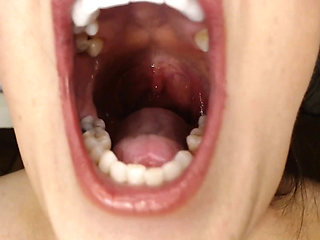 Throat and Mouth Spit Strings Uvula Tonsils Uvula