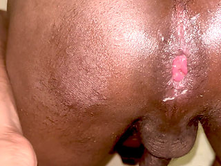 Indian gay prolapse teen 18+