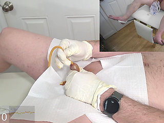 Foley Catheter and Bladder Filling