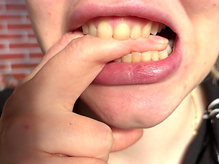 Finger & Hand Biting Deep Marks & Licking