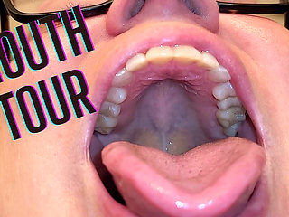 Mouth Tour with a Bottom Retainer