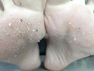 Dirty and Natural Toenails