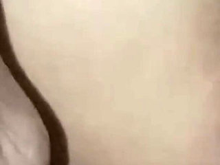 A Girl Who Asked Me to Help Her with a Shaved Head.