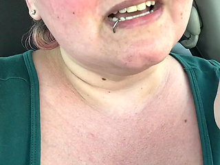 Got a Sunburn for Art Supplies!