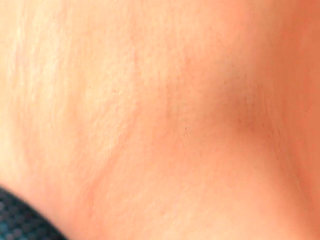 The Skin of My Armpits Is so Delicate