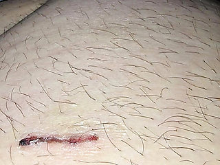 Step mom help injured step son with low erection with a handjob