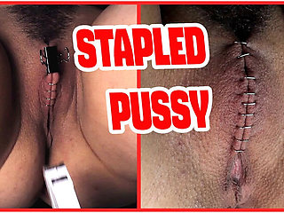 Sadistic Doctor Staples Teen Goth Girl's Hairy Pussy in Extreme BDSM Medical Punishment