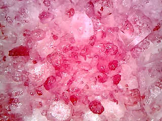 Medical Endoscope Oral Exam: Gummy Chewing, Extreme Teeth & Tongue Macro
