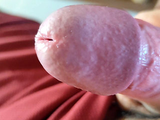 The Blossoming of Extensive Elastic Phimosis.
