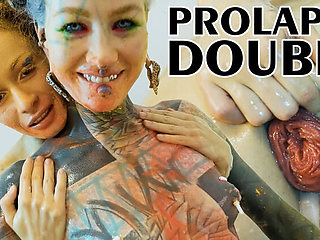 Anal Fisting Fun with Stacy Bloom and Anuskatzz - Lesbian Anal Action