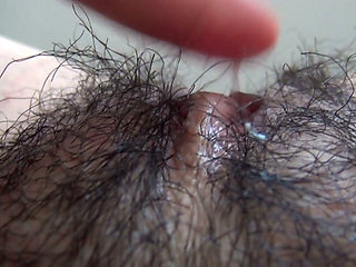 The Mound of the Clitoris