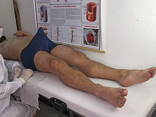 Nurse Observes Patient's Erection