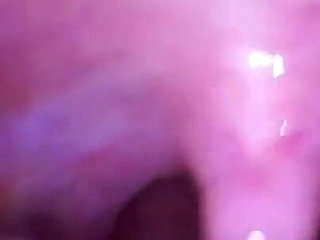 Deep Inside Sydney's Mouth - Sydney Screams Shows off Mouth, Tongue, Throat, and Uvula with Endoscope