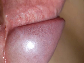Amazing Upright Rough Venous Frenulum