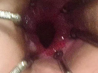 Enema, anal shower. Close-up view through anal mirror. Anal with water. Filling anal with water