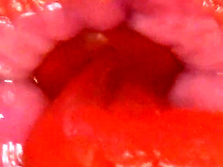 Omg! I Swallowed Big Flamingos at the Same Time!